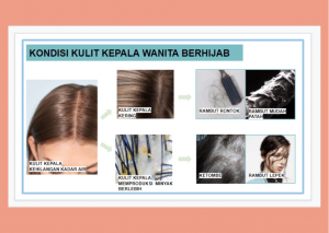 kondisi kulit kepala berhijab