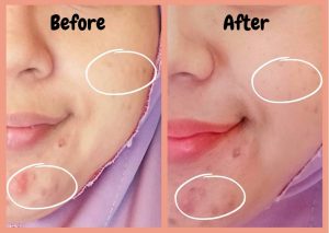 Review Scarlett Niacinamide Serum