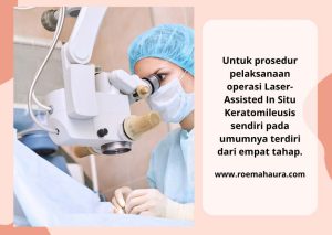 Prosedur LASIK