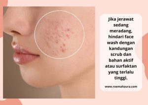 face wash acne