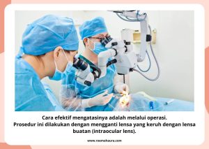 operasi katarak